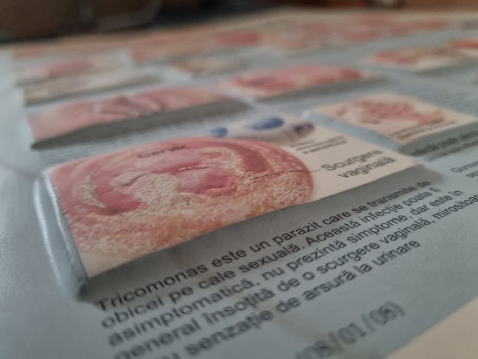 Plansa Afecțiuni Ginecologice Uzuale