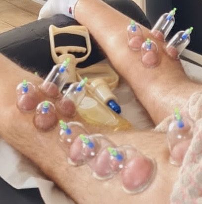 Active therapy & recovery | Terapie manuala si recuperare musculara