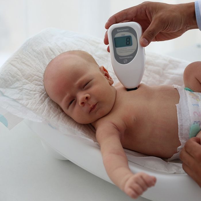 Аренда фотолампы, фотолампа, лампа от желтушки, желтуха