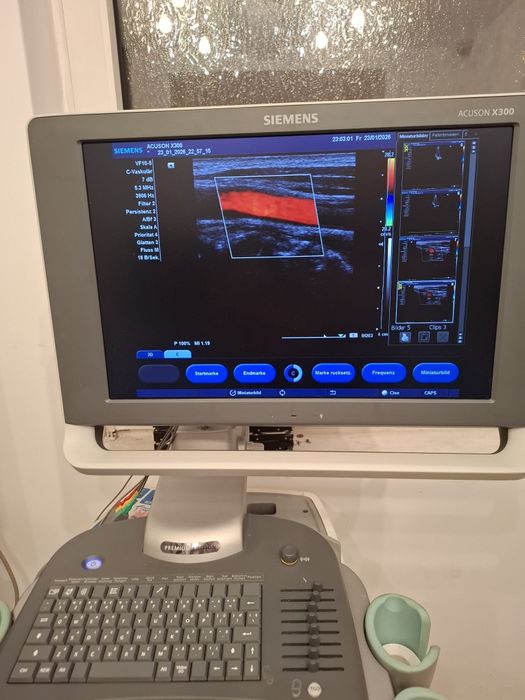 Ecograf Doppler color Siemens seria X PE