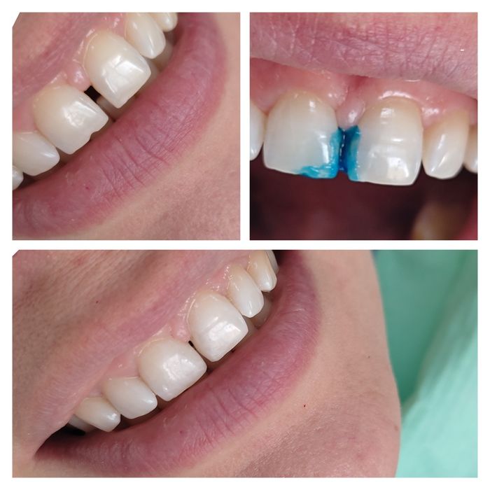 Услуги стоматолога