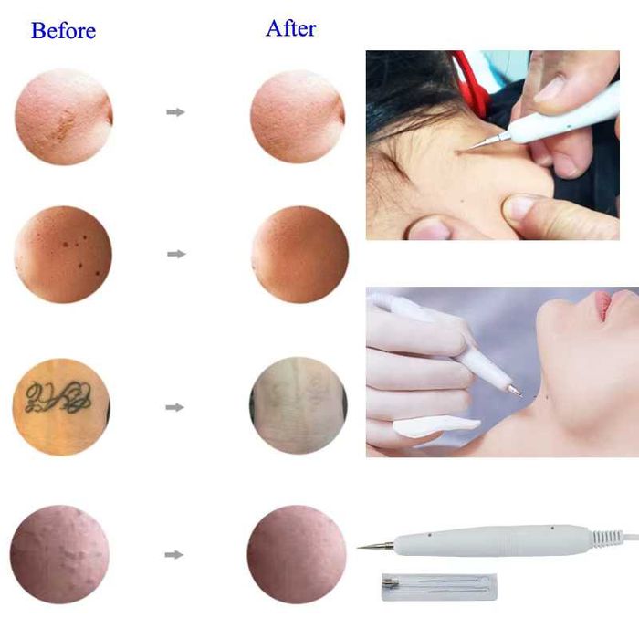 Aparat cosmetic 16 în 1 profesional pentru tratamente faciale + cadou gratuit - Încălzitor de prosoape cu sterilizator UV