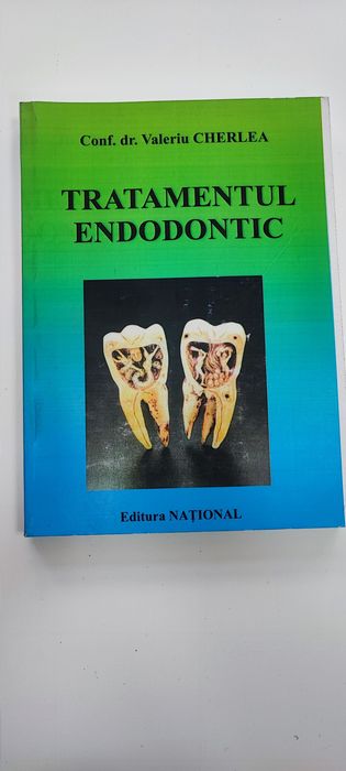 Tratamentul endodontic