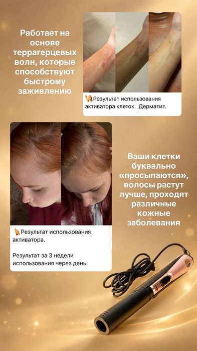 Прибор активирует клетки. Оригинал