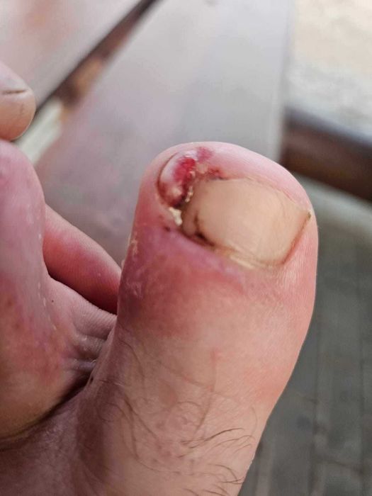 Podologica Pedichiura complexa