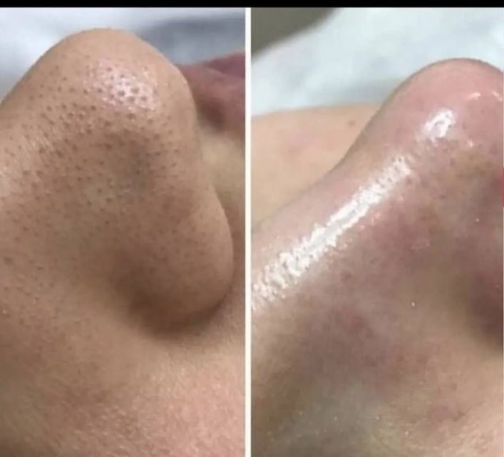 Косметолог для женщин чистка лица пиллинг возможно выезд м. Шахристон