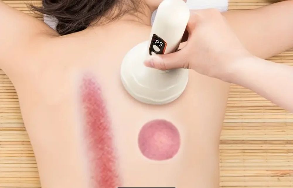 Электро банка вакуумная