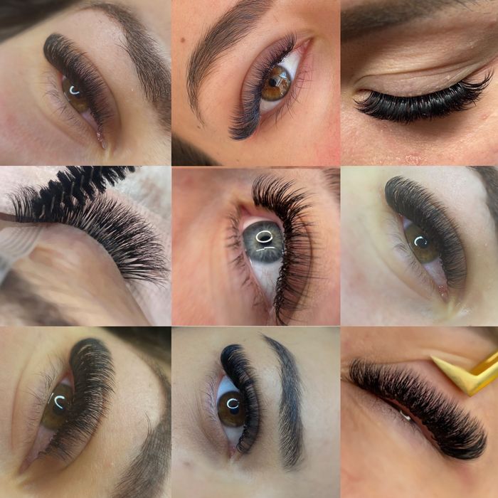 Курс Миглопластика 800 гр. Стара Загора