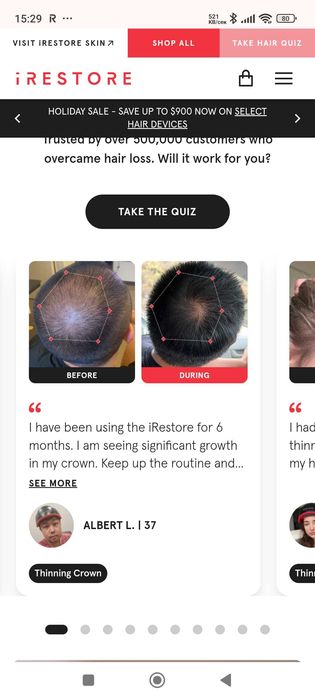 iRestore hair growth system Нискоенергийна лазерна терапия при косопад
