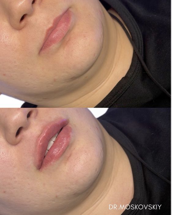 Косметолог | Алмата