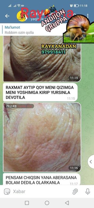 Yuzdagi ajinlarni ketkizuvchi nabor