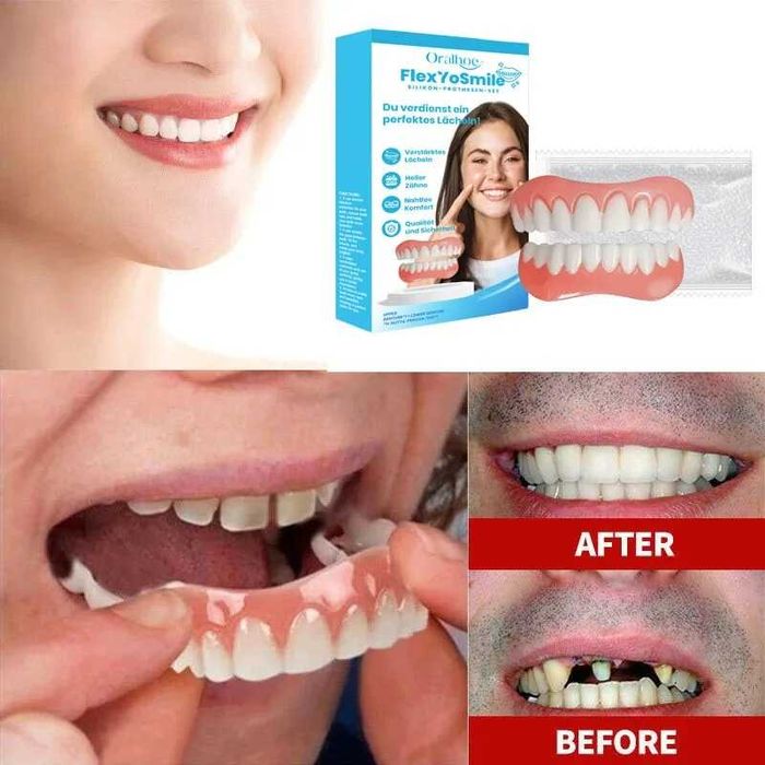 Kit proteza silicon, captuseala din silicon, kit proteza moale, kit proteza moale, dinti superiori si inferiori, set usor de utilizat