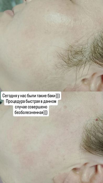 Шугаринг всего тела