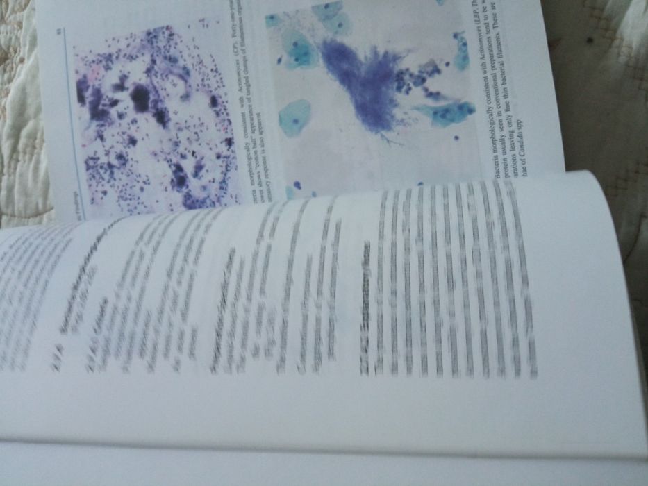 Bethesda citologie(The Bethesda Sistem -pentru raportarea citologiei cervicale)