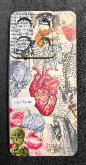 Кейс за Xiomi Redmi note 13pro