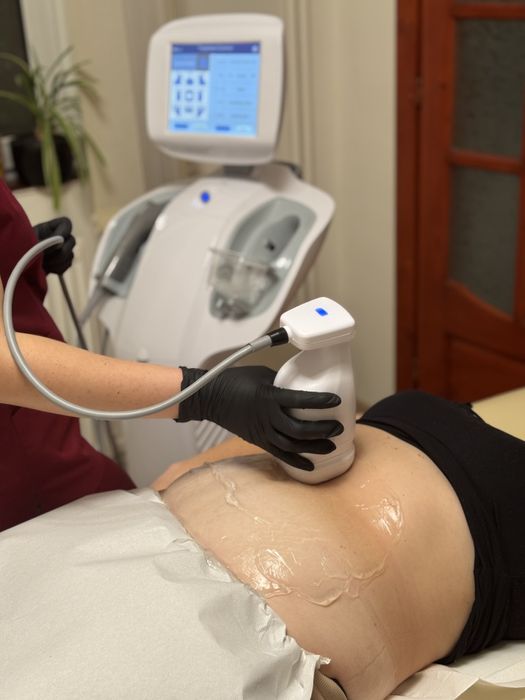 Remodelare cu ultrasunet - LipoSlim & HIFU
