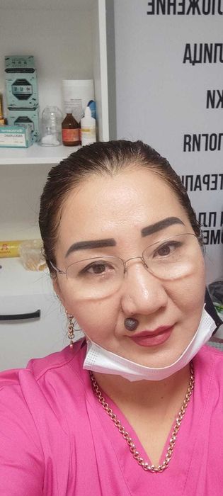 Хиджама Астана кровопускание