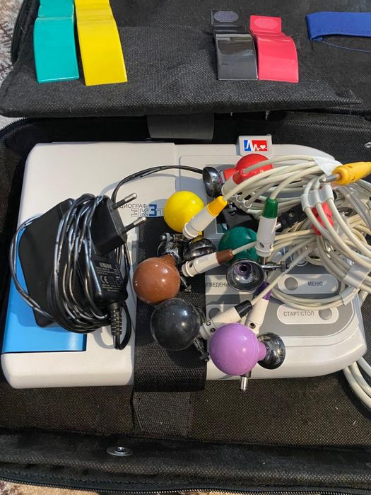 Электрокардиограмма