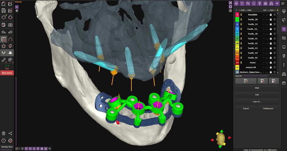 Realguide 5.4.2 + ImplantStation 5.3.2 + BlueSkyPlan + ImplantStudio