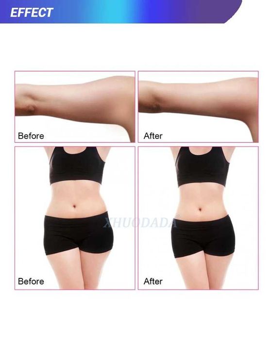 Aparat Profesional de Masaj si Tonifiere pentru San cu Vacuum