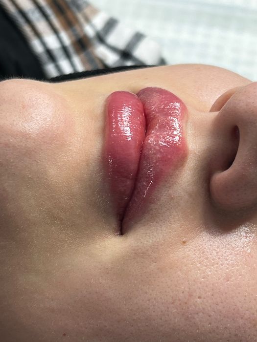 Косметологические процедуры