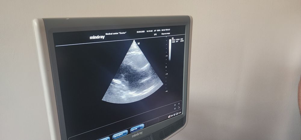 Миндрай дс7 узи аппарат