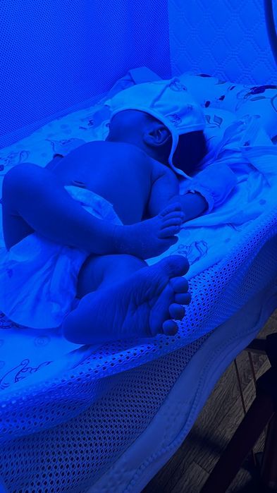 Аренда фотолампа от желтушки