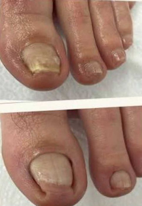 55 Lei Ofer sercivii de cosmetizare calcaie si pedichiura cosmetica  la domiciliul clientei - Bucuresti