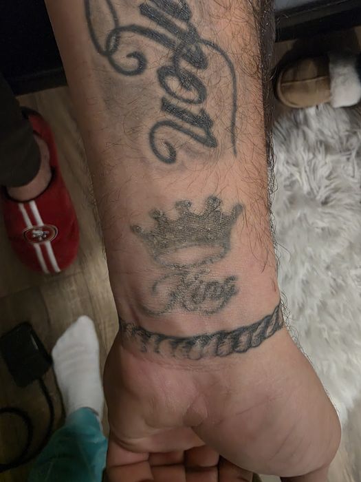Epilare cu ceara de unica folosinta,micropigmentare,indepartari tatuaj
