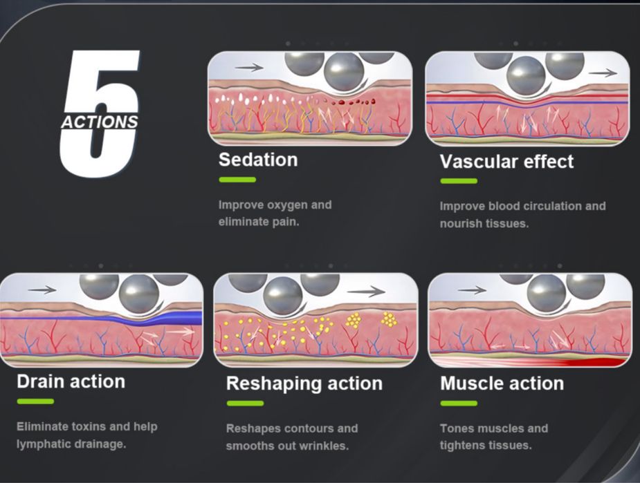 Ролашейп. Антицелулитен апарат