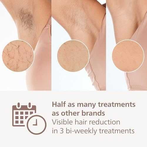 Нов Philips Lumea 9900 IPL уред премахва косми фотоепилатор BRI953/02