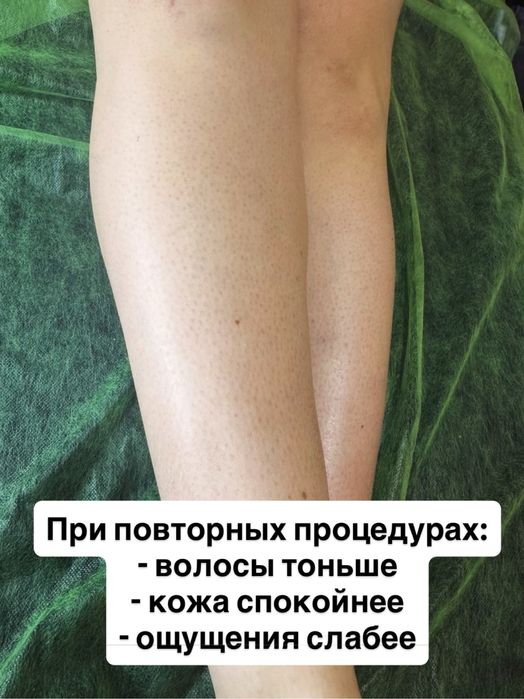 Шугаринг, депиляция полимером