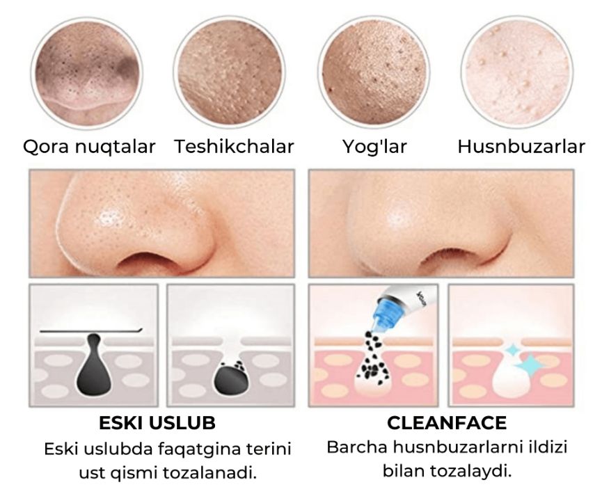 Вакуумный аппарат очиститель для лица