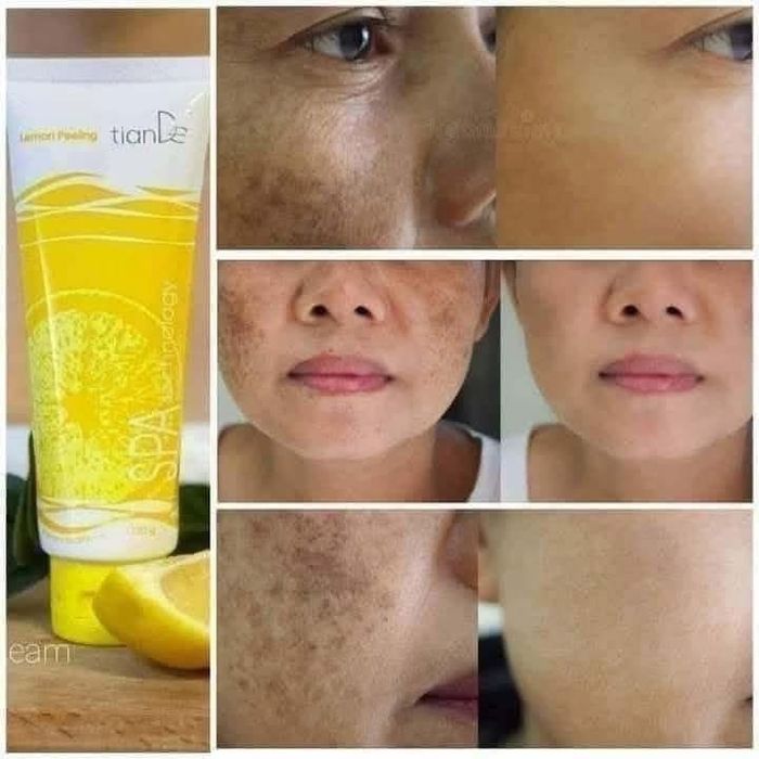 Пилинг лимон за лице