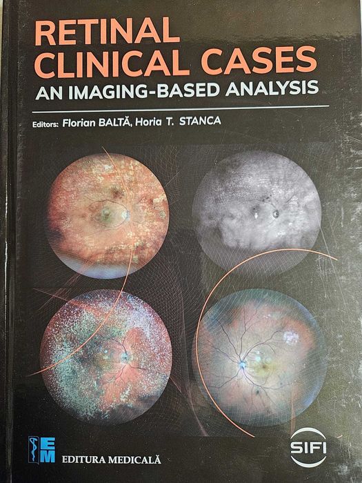Carti Oftalmologie (Medicina) noi-noute