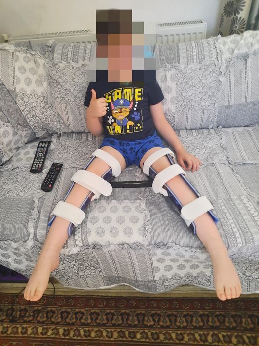 Donez proteză șolduri