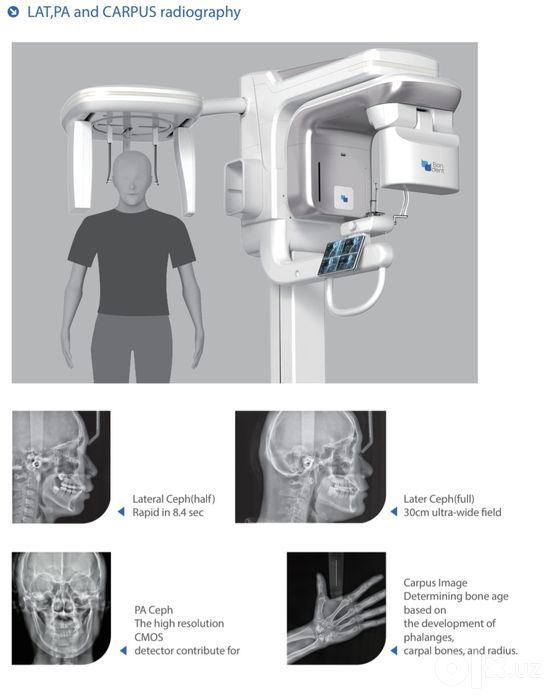 Rentgen Bondent CBCT- 1030 pro