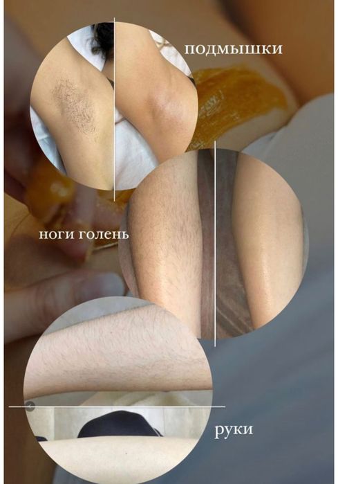 Шугаринг  на всё тело!