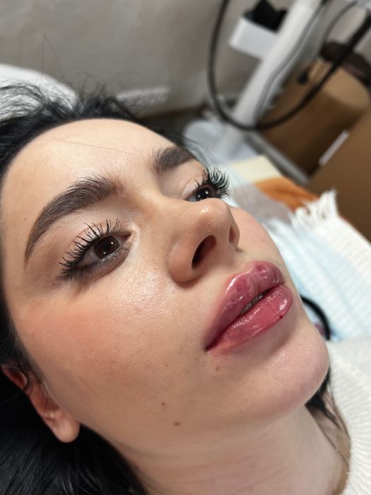 Косметологические процедуры