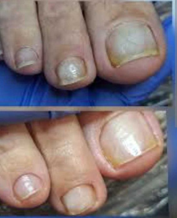 55 Lei Ofer sercivii de cosmetizare calcaie si pedichiura cosmetica  la domiciliul clientei - Bucuresti