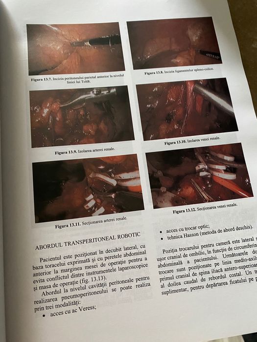 Tratat de uro-oncologie