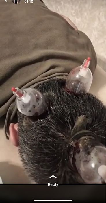 Хиджама Астана хиджама в астане