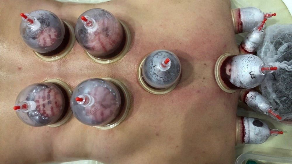 Хиджама Каскелен