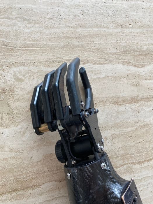 Протеза за ръка (миоелектрична)