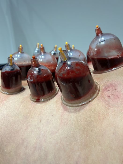 Хиджама в Караганде ! В центре !