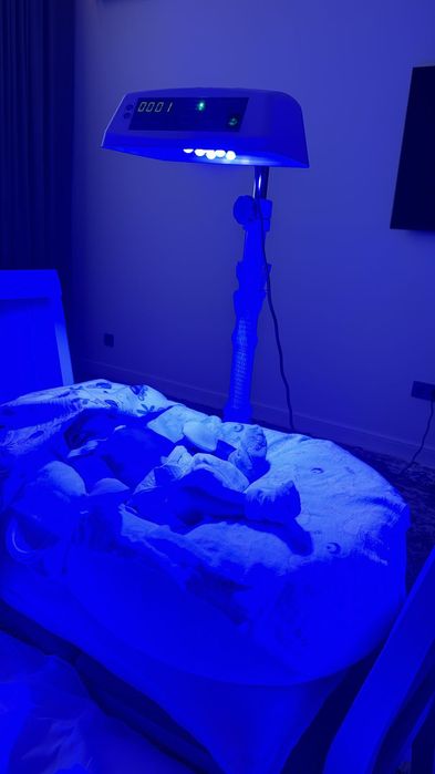 Аренда фотолампы, фотолампа, лампа от желтушки, желтуха