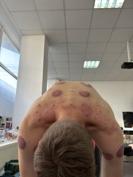 Masaj De Calitate Oradea - Terapie Manuala - locație sau domiciliu