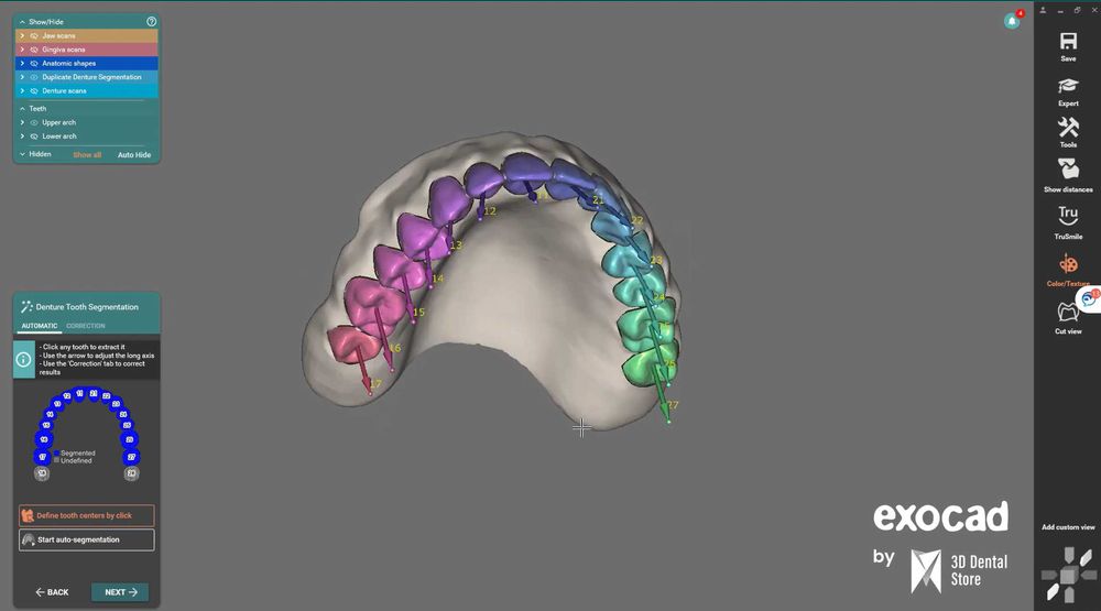 EXOCAD 3.3 Chemnitz + PartialCAD ​​3.3 + ExoPlan 3.1 + B4D iBar