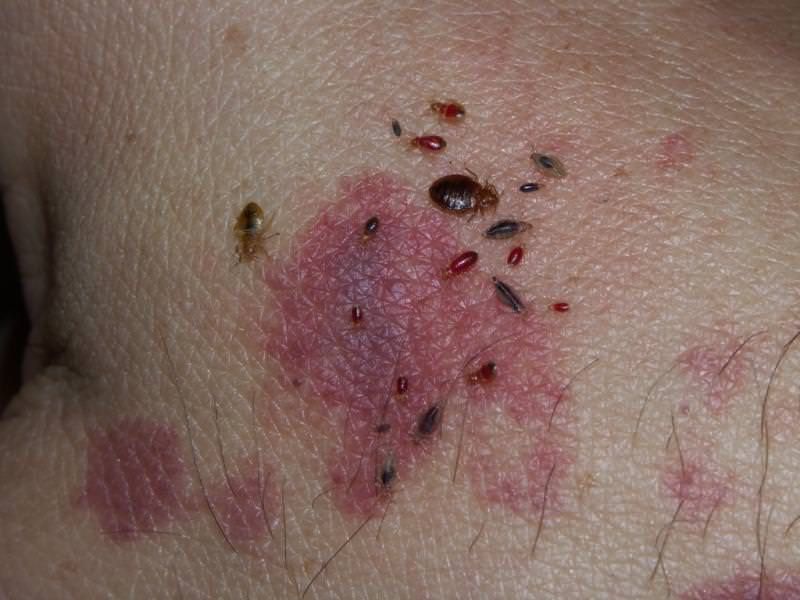 20 Скидка Дезенфекция дизенфекция дезинфекция дизинфекцияdizinfeksiya