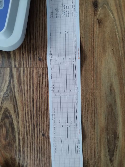 Electrocardiograf Nihon Kohden ECG-2150